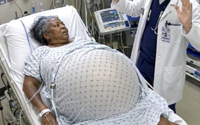 A 65-year-old woman was stunned to discover she was pregnant—but when the time came to give birth, the doctor’s examination revealed something that left everyone in shock.